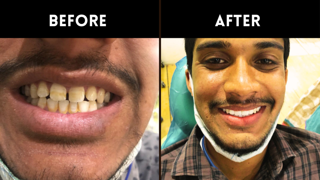 Affordable Dentist In Sainikpuri