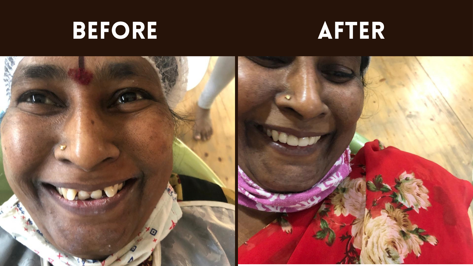 Best Dental Clinic In Sainikpuri