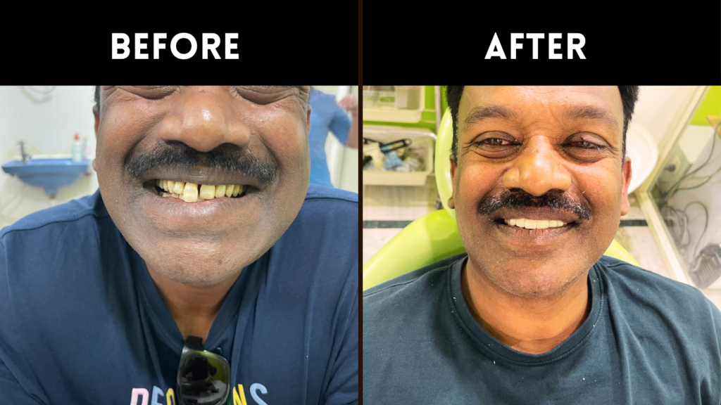 Best Dental Doctor In Sainikpuri