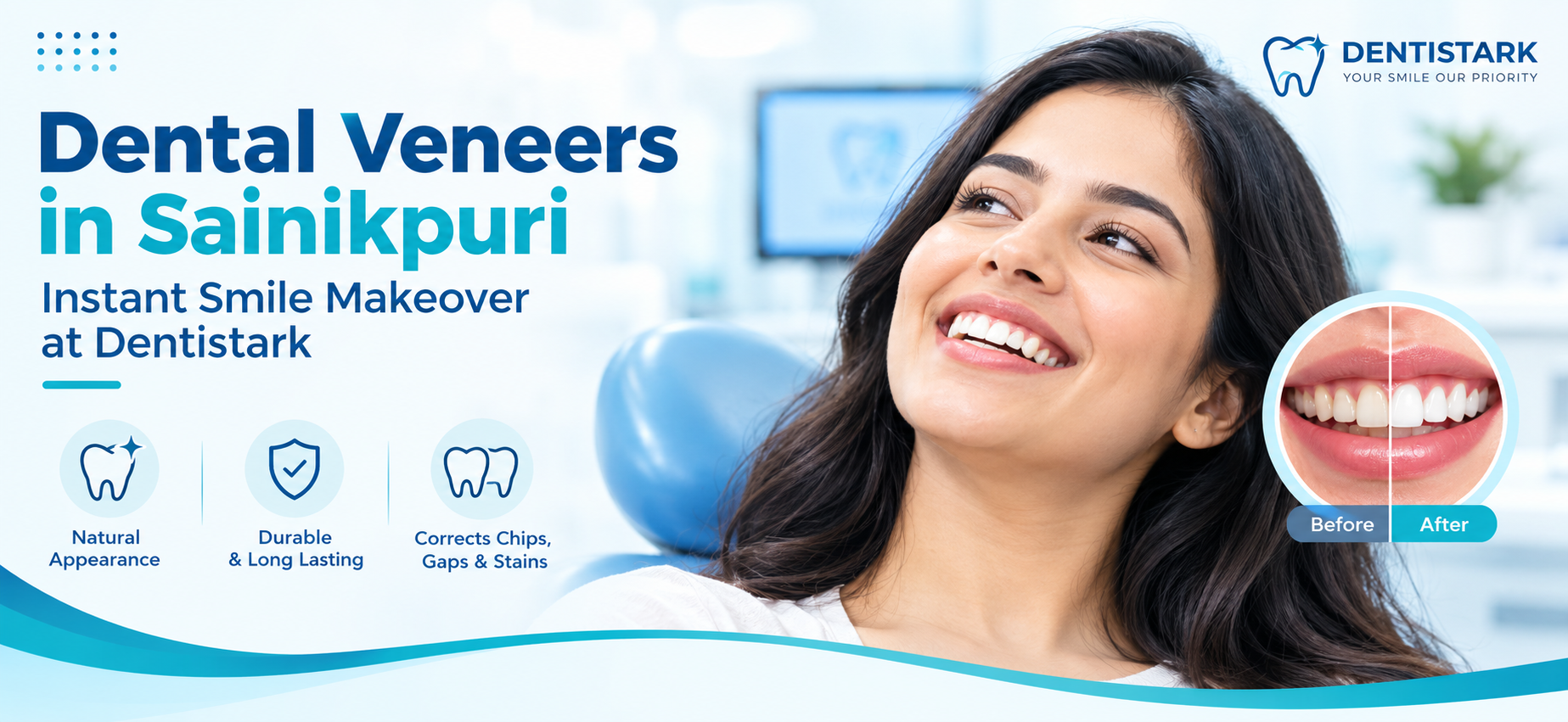 Dental Veneers Specialist