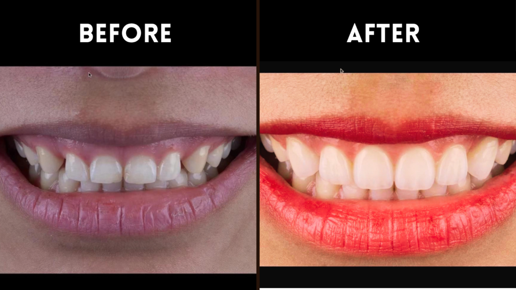 Dental Care In Sainikpuri