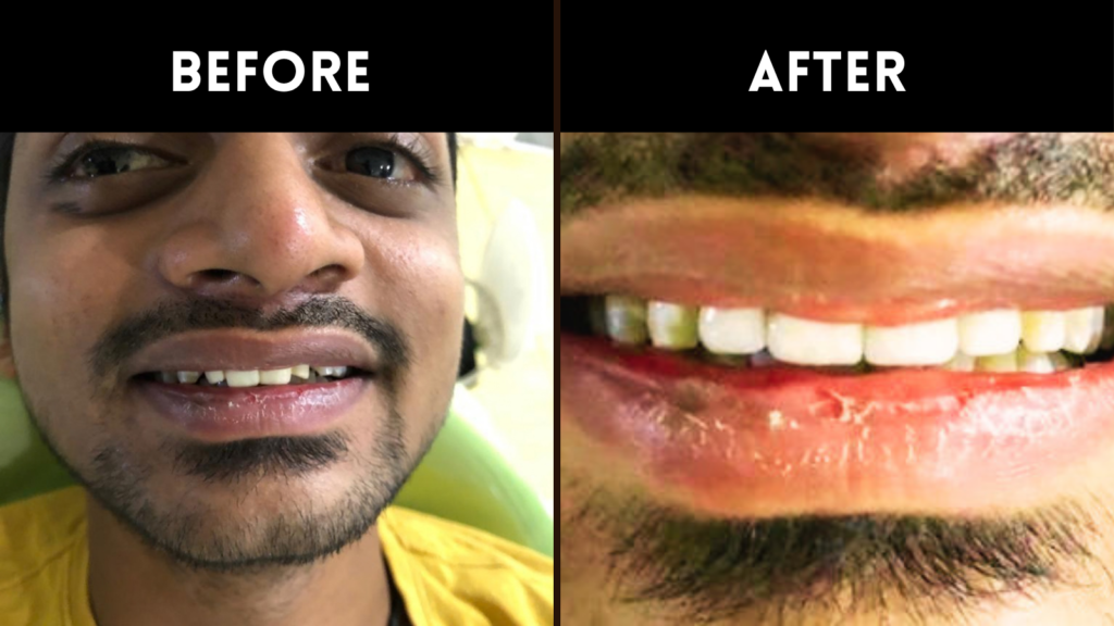 Dental Specialist in Sainikpuri