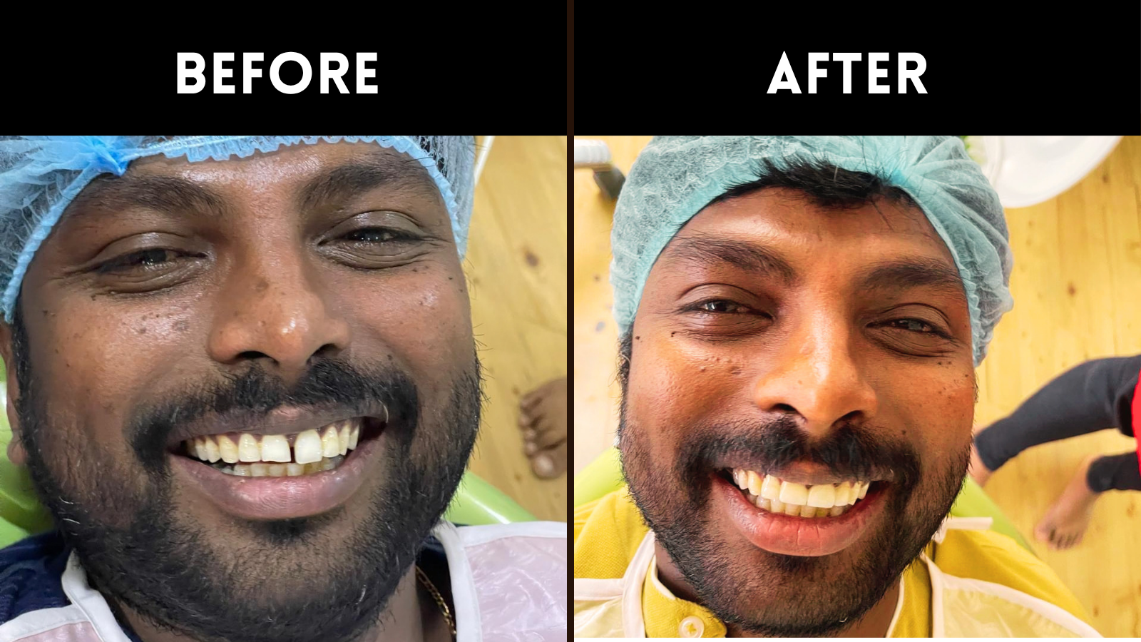 Dental specialist in sainikpuri