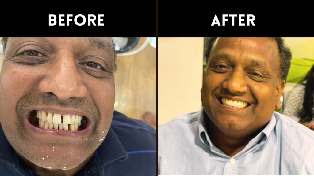 Dentist In Sainikpuri