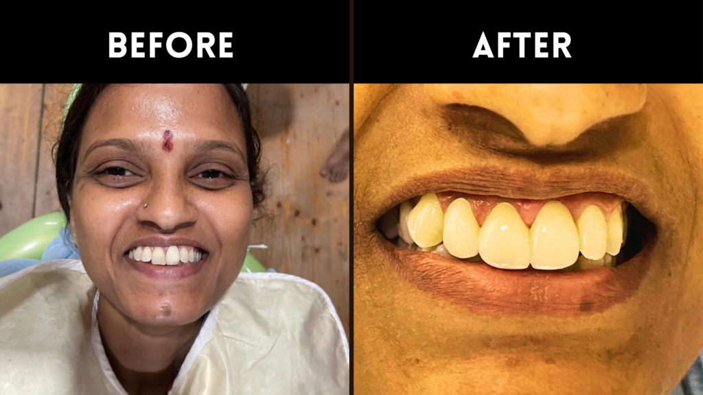 Dentist Near Sainikpuri