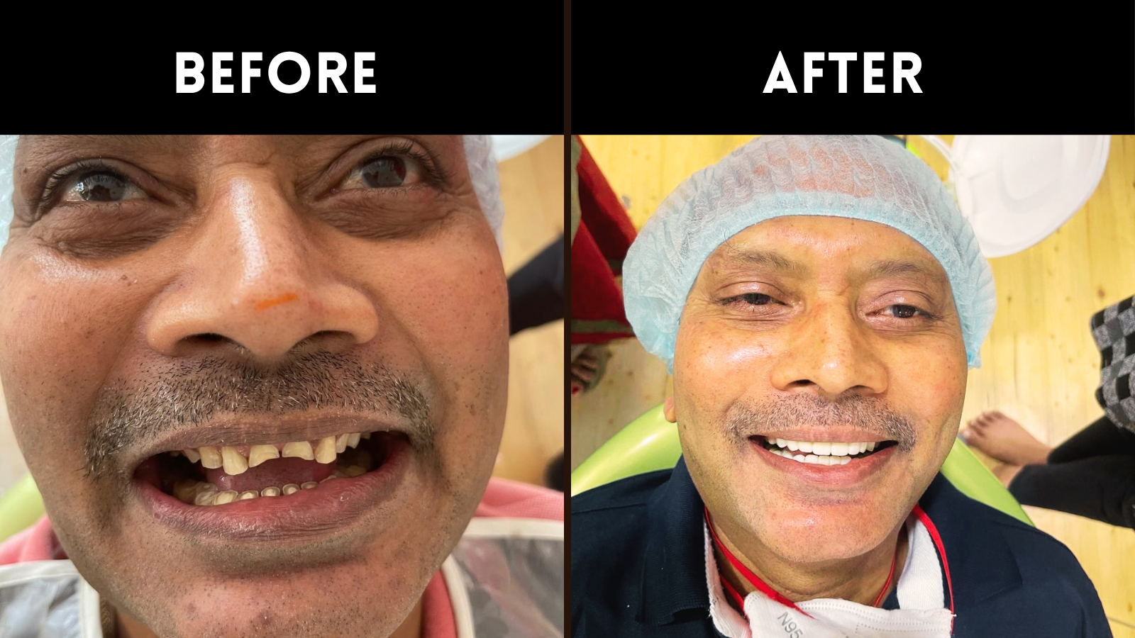 Experienced dentist in sainikpuri