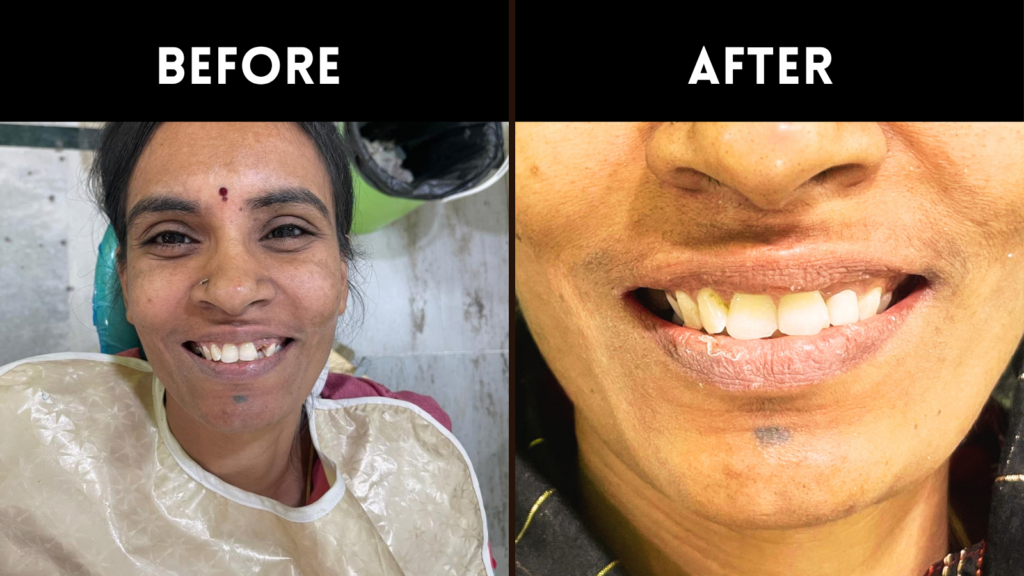 Family Dentist In Sainikpuri
