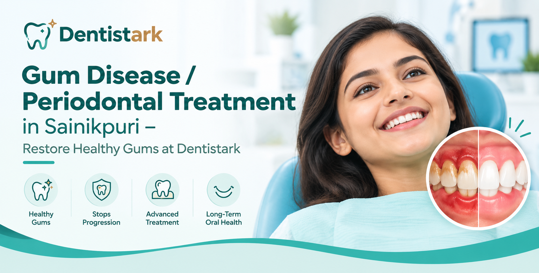 Gum Disease Periodontal Treatment in sainikpuri