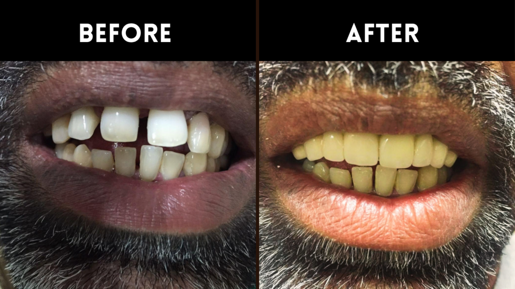 Dental Services in Sainikpuri