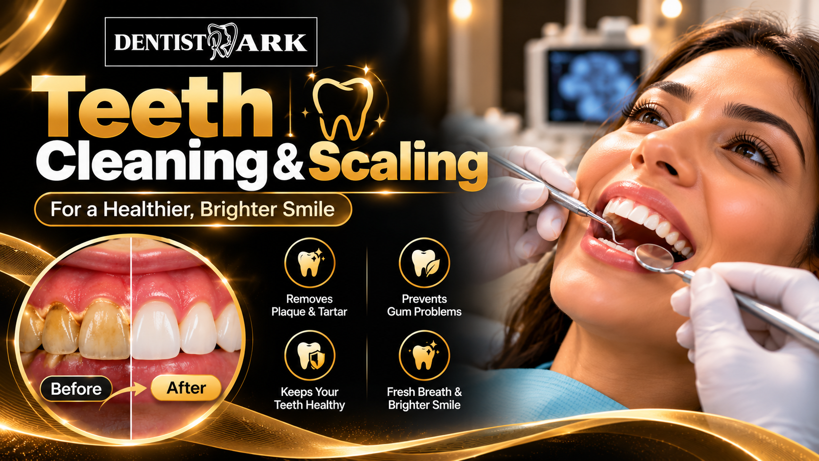 Professional teeth cleaning and scaling at DentistArk in Sainikpuri, Secunderabad